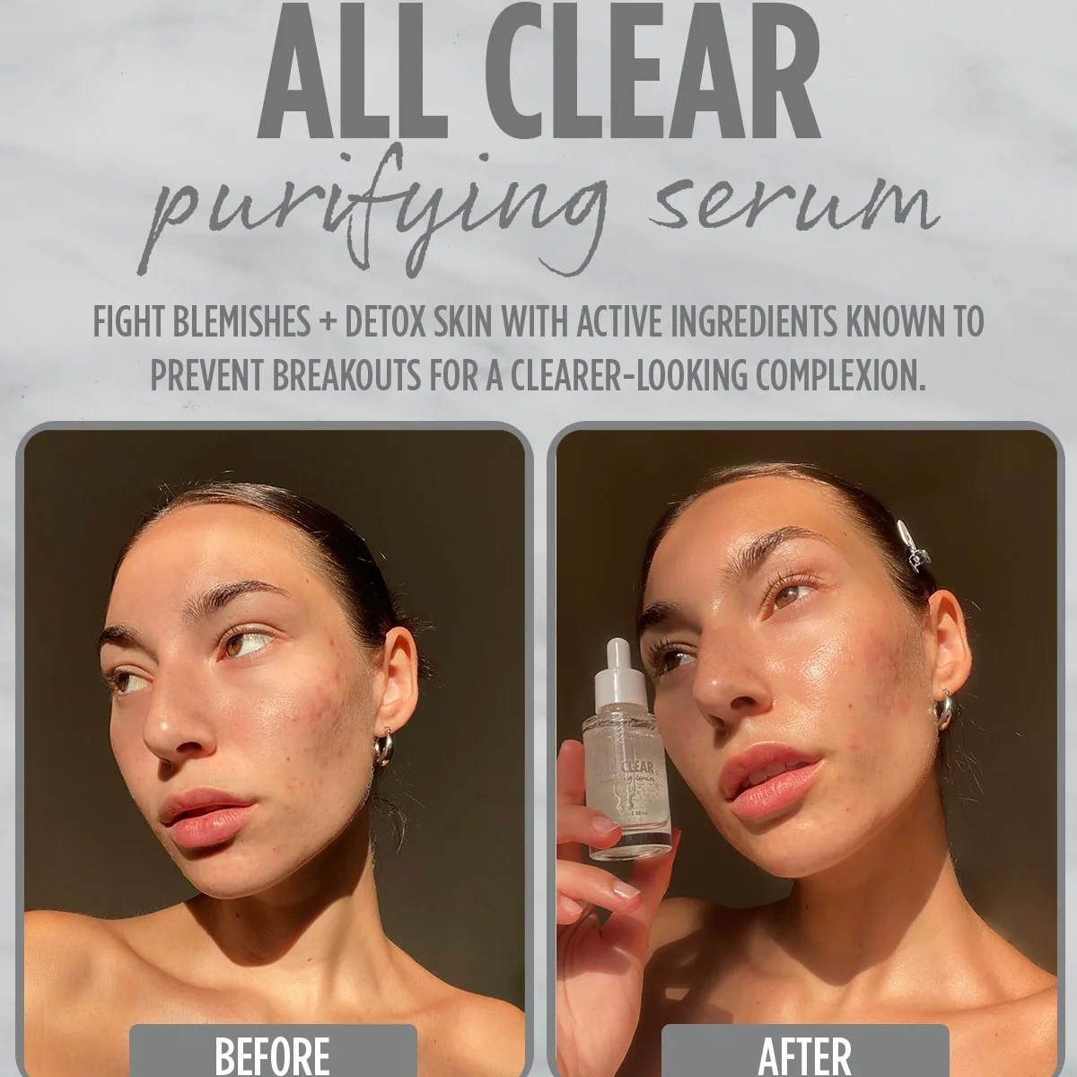 All Clear Purifying Serum - Image 3